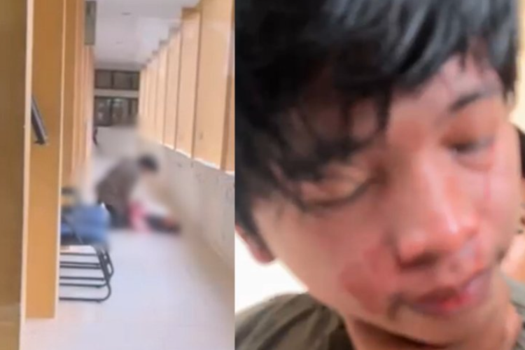 Ngeri! Mahasiswi UIN Riau Dibacok Teman di Lokasi Sidang Skripsi, Begini Kata Polisi