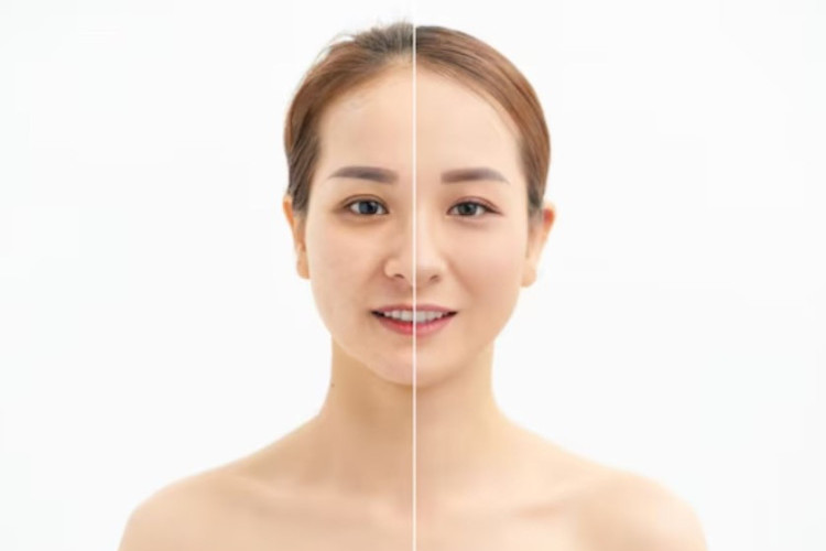 Berapa Harga Suntik DNA Salmon di Klinik Kecantikan? Segini Besaran Perawatan untuk Kulit Cerah!