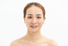 Berapa Harga Suntik DNA Salmon di Klinik Kecantikan? Segini Besaran Perawatan untuk Kulit Cerah!